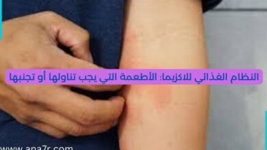 النطام الغذائي للاكزيما