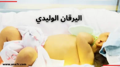 اليرقان الوليدي